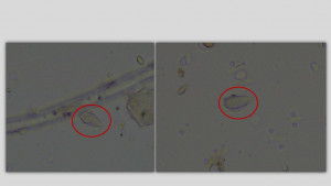 foto aerospore Pyricularia